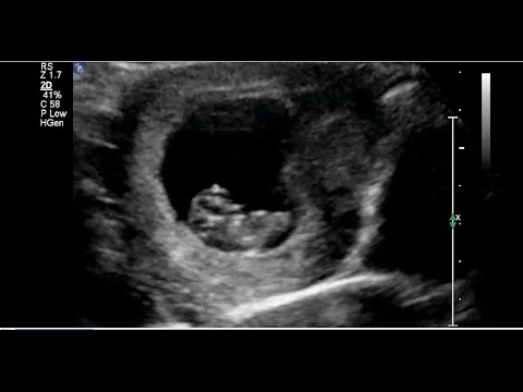 Video: Hamileliğin 9. Haftası Nasıldır
