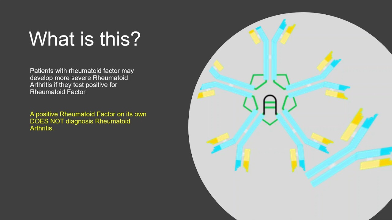 What Does a Positive Rheumatoid Factor Really Mean? - YouTube