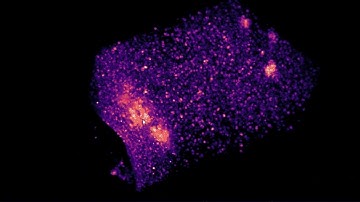 3D view of a mouse colorectal tumor