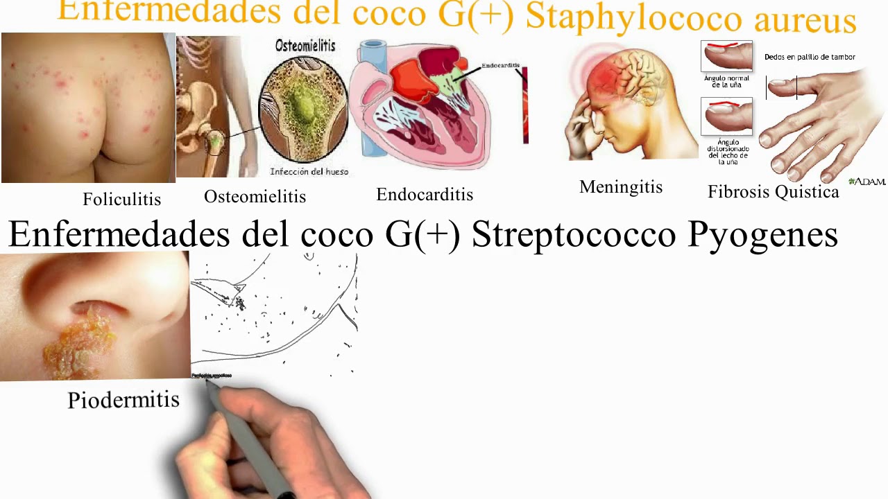 enfermedades producidas por bacterias bacilos