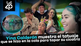 Yina Calderón muestra el tatuaje que se hizo en la cola para tapar la cicatriz de los biopolímeros 😱