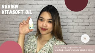 Review vitasoft oil penghilang bekas luka,bekas koreng, gigitan nyamuk,AMPUH BANGET screenshot 2