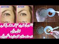 Lotion For Under Eye Wrinkles Removal || How To Remove Under Eye Wrinkles