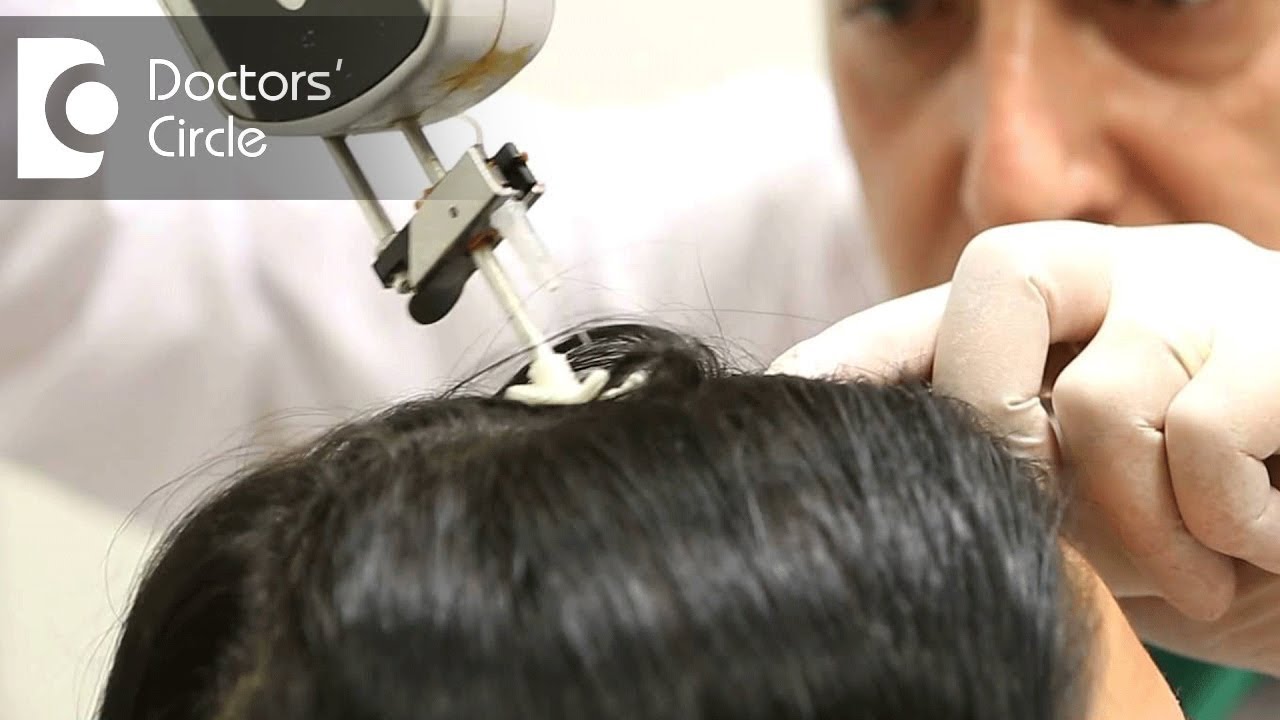 Mesotherapy For Hair  Procedure Results Side Effects And More