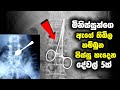 මිනිස්සුන්ගෙ ඇගේ තිබිල හම්බුන අරුම පුදුම දේවල් 5ක් මෙන්න | 5 Craziest Things Swallowed By People