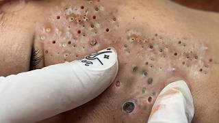 𝑳𝒖𝒙𝒖𝒓𝒚 𝑭𝒂𝒄𝒊𝒂𝒍 𝑬𝒔𝒄𝒂𝒑𝒆 𝑭𝒐𝒓 𝑫𝒆𝒆𝒑 𝑹𝒆𝒍𝒂𝒙𝒂𝒕𝒊𝒐𝒏 𝒂𝒏𝒅 𝑰𝒏𝒏𝒆𝒓 𝑷𝒆𝒂𝒄𝒆 #117213