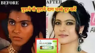 पुराने से पुराने दाग़ घब्बे, Pigmentation को चुटकी में खत्म कर चमकदार त्वचा बनाएं | Usefullproducts