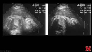 Ultrasound2BasicDisplay