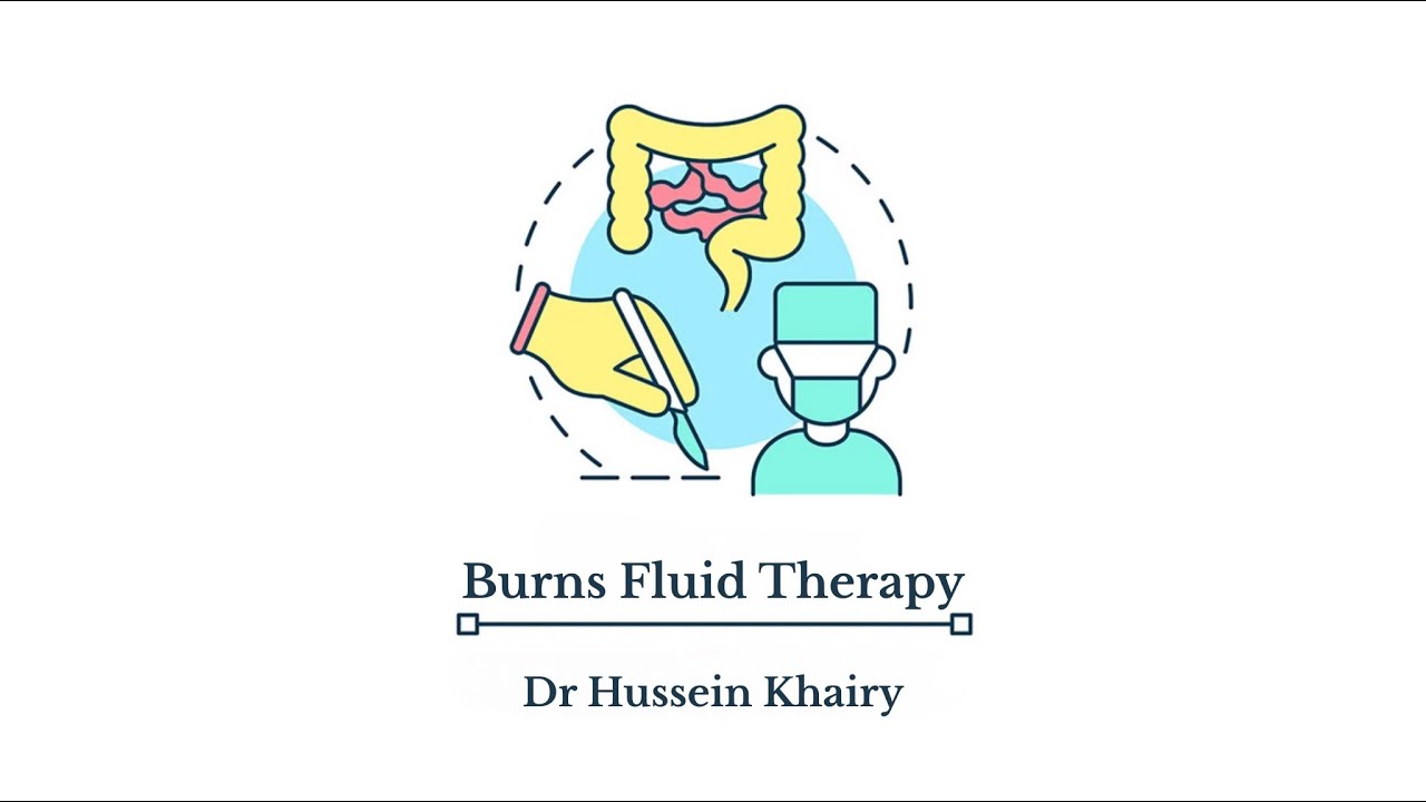 Burns fluid therapy by Dr Hussein Khairy [103]