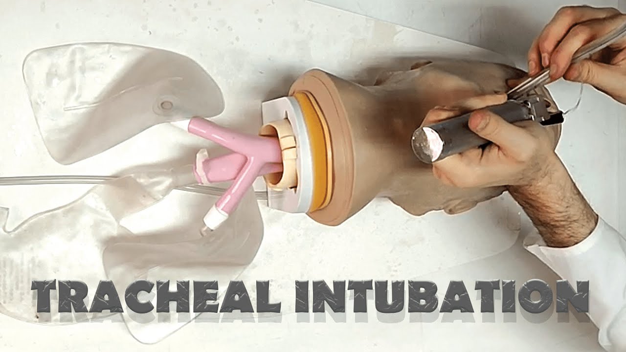 Tracheal tube placement INTUBATION YouTube