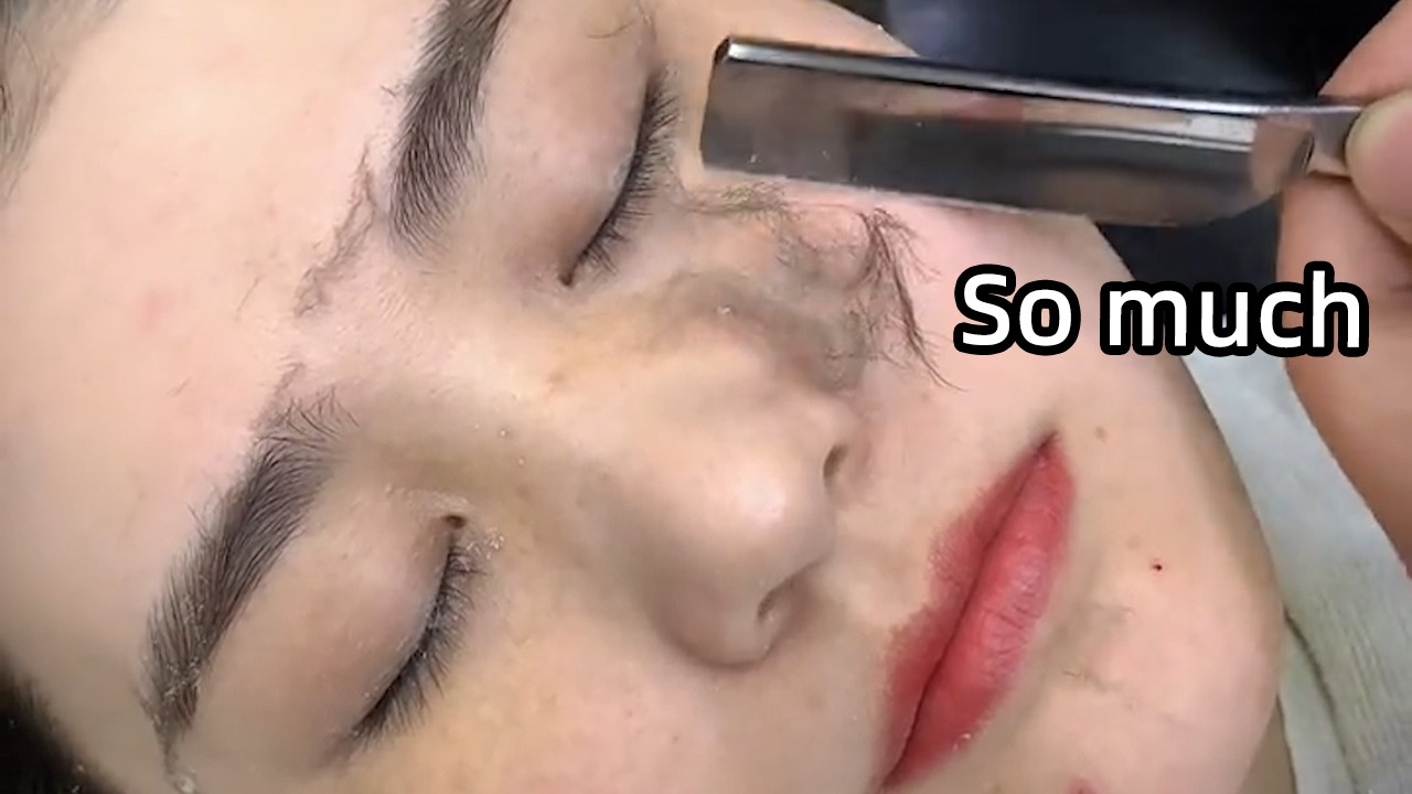 💈ASMR | I've never seen such a beautiful lady with so much vellus hair on face! 🪒 Shave dead skin！