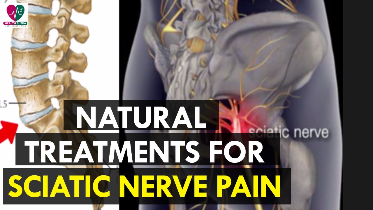 Natural Treatments for Sciatic Nerve Pain Health Sutra YouTube