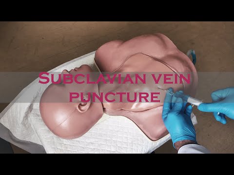 Пункція і катетеризація підключичної вени / Subclavian vein puncture ENG subtitles