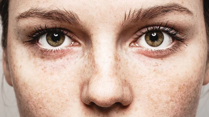 The Truth About Freckles - DayDayNews