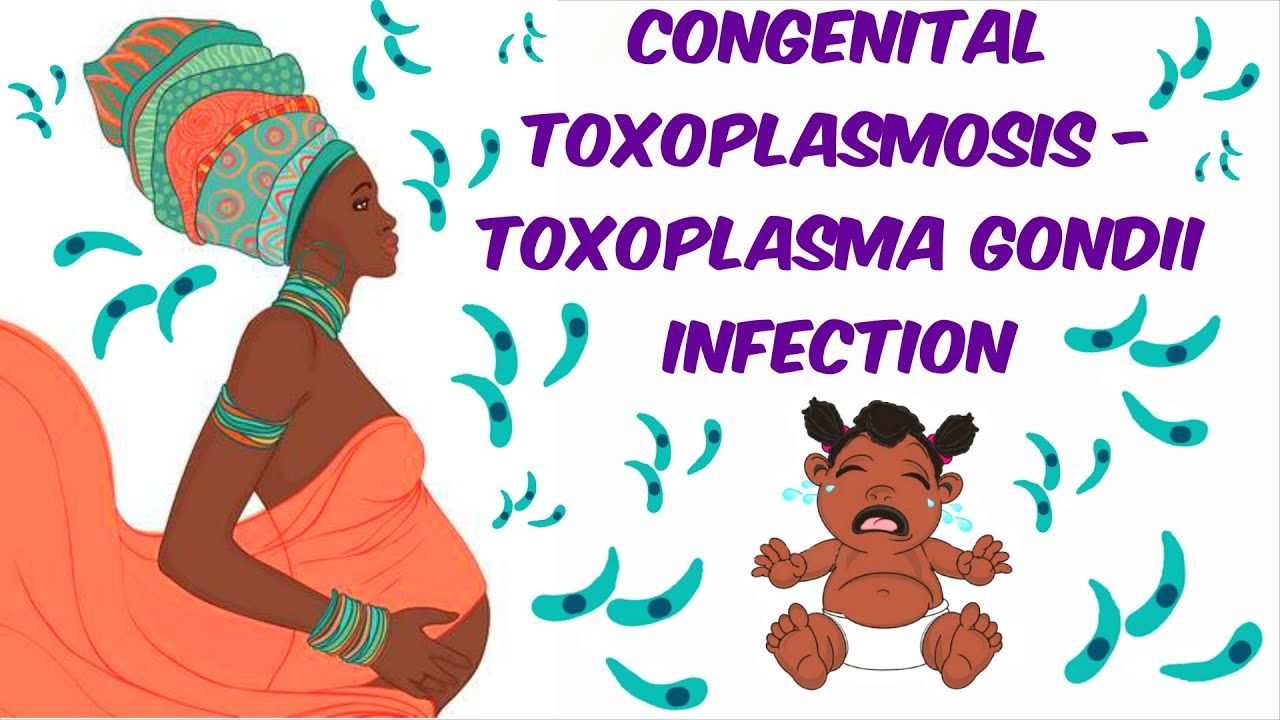 Terhesség alatti toxoplasma, veleszületett toxoplasmosis