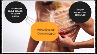 СТРЕЛЯЮЩАЯ БОЛЬ В ОБЛАСТИ ГРУДНОЙ КЛЕТКИ, МОЖЕТ ОТДАВАТЬ СЕРДЦЕ ИЛИ ИМИТИРОВАТЬ ЗАБОЛЕВАНИЕ ЖКТ.