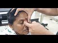 Testimonial by DCR patient - Aum Hospital/ Om Hospital - Dr Hitesh Patel