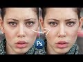 Уроки Фотошопа | Как убрать круги под глазами / Обработка фотографий в Photoshop