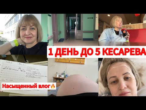 видео: В РОДДОМЕ🤰ДО 5 КЕСАРЕВА 1 ДЕНЬ😳