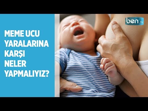 Video: Bebeğin Meme Ucu Ne Sıklıkla Değiştirilmelidir?