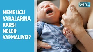 Meme Ucu Yaraları Nasıl Geçirilir?