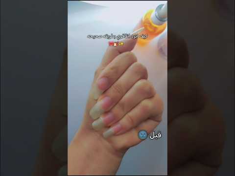 برد الاظافر بشكل حلو اكسبلور    