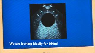 Celebrity Bladder Scanner Calibration Tutorial from Win-Health.com Net Worth