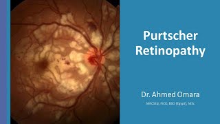22 Wills eye manual - Purtscher Retinopathy (Arabic narration)