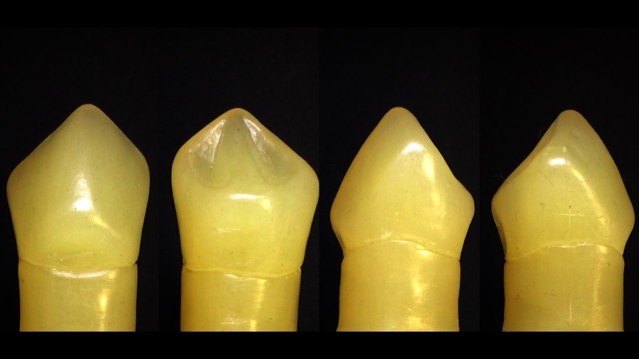 Carving UPPER 3 (MAXILLARY CANINE ) .