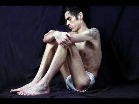 ЧТО БУДЕТ,ЕСЛИ ПЕРЕСТАТЬ ЕСТЬ (ГОЛОДАНИЕ) ИЛИ ПЕРЕЕДАТЬ ?