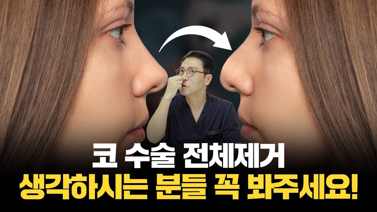 257화. 코수술 후 전체제거 생각하시는 분들 꼭 봐주세요.