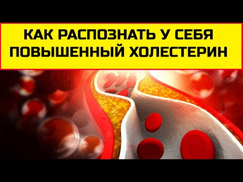 Как обнаружить высокий холестерин и чем он опасен. Первые симптомы повышенного холестерина. Как обнаружить высокий холестерин и чем он опасен. Первые симптомы повышенного холестерина.