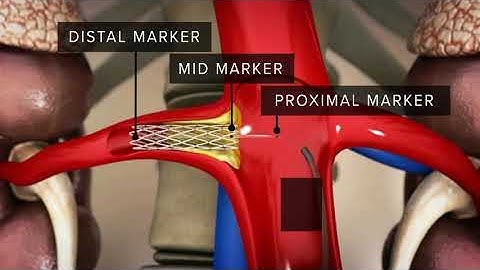 FLASH Animation (Standard)