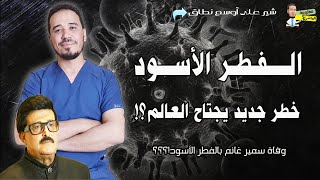 الفطر الأسود (Mucormycosis) | ووفاة سمير غانم