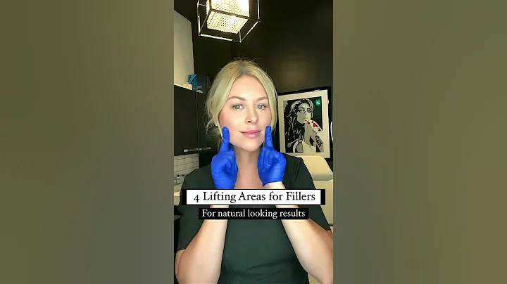 Where can I get a face lift with a natural look? Book your filler appointment at skinvitality.ca