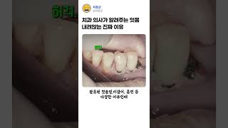 잇몸 내려 앉는 주범의 정체 ㄷㄷㄷ