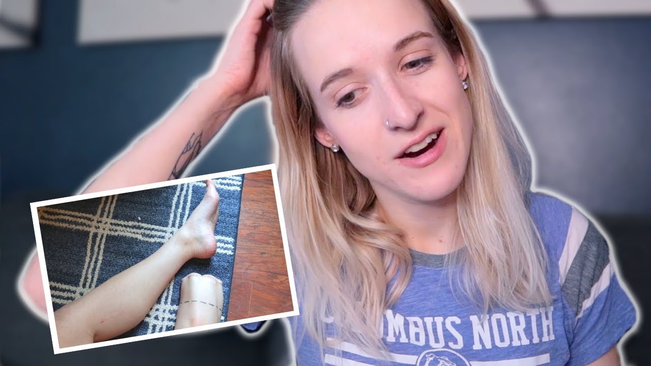 My leg is ACTUALLY getting cut off again here's what's happening