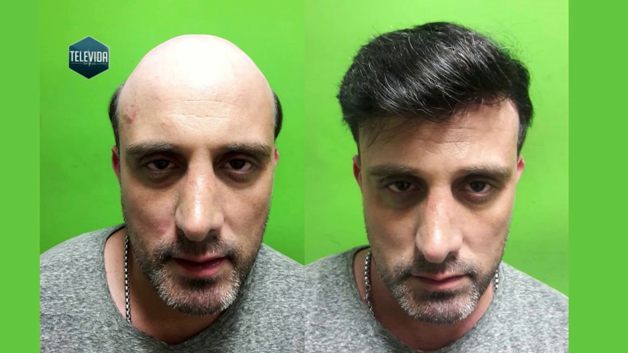 Testimonio Alpha Hair Rosario. YouTube