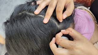 Relaxing 🫠 ASMR sounds of nits picking