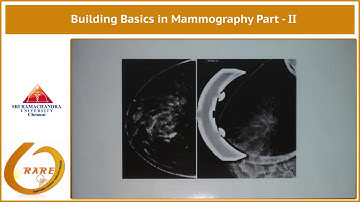 Building Basics in Mammography Part - II