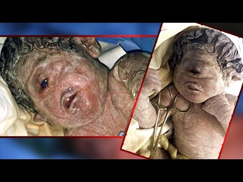 Baby Born With ONE Eye And NO Nose! | Shocking News | Strange Tv