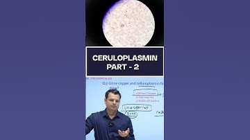 Explain Ceruloplasmin part - 2 #chandanmlt #rankplus #labtechnician#shortvideo #youtubeshorts