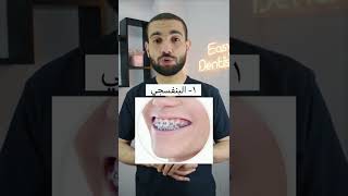 أجمل الوان تقويم الاسنان ✅❤️ لازم تختار واحد فيهم👌🏼