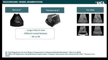 IPCAI 2021 #23 - Vessel Segmentation for Registration of Laparoscopic Ultrasound to CT of the Liver