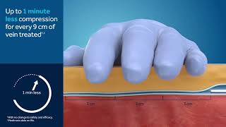 Medtronic's VenaSeal™ Closure System product animation