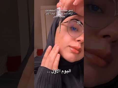 سيروم ازلك اسد من انوا  مايكاب اكسبلور تجميل  قابس  ترند