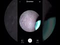 Ear cleaner with a camera!