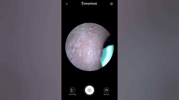 Ear cleaner with a camera!