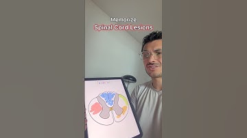 Let’s memorize the Spinal Tracts & Conditions 🧠 #medstudent #medschool #medicalschool #usmle