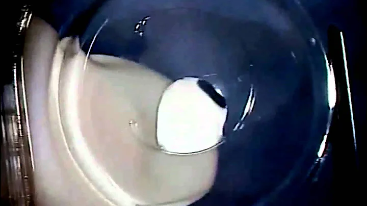 CTR Insertion by Dr. Jeffrey Whitman